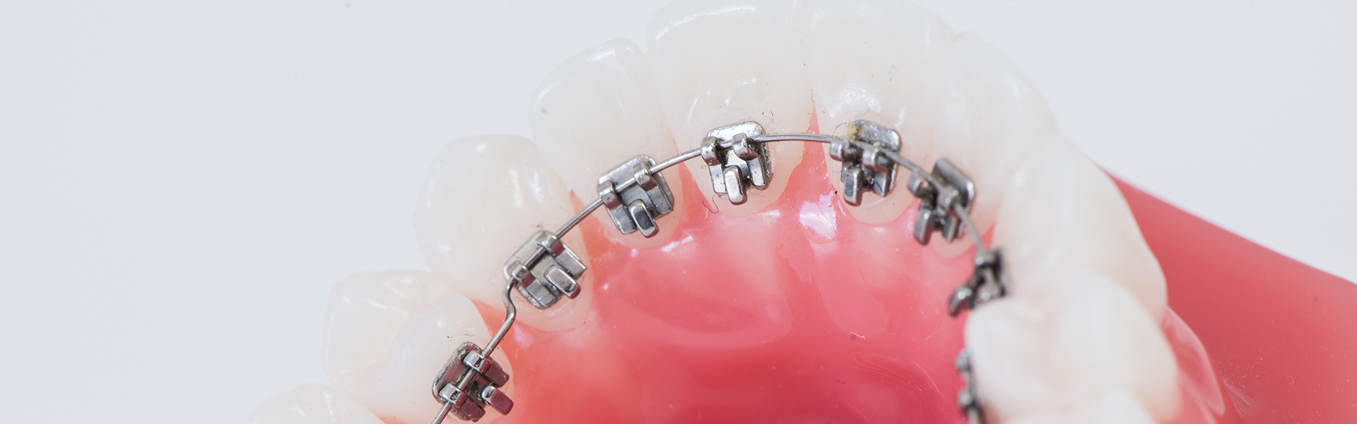 10 Bases En Maille Collantes Pour Retenue Linguale Orthodontique - Marque SKYSEA Ref L35
